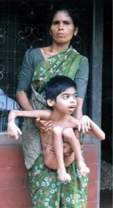 インドで農薬の被害に苦しむ子ども